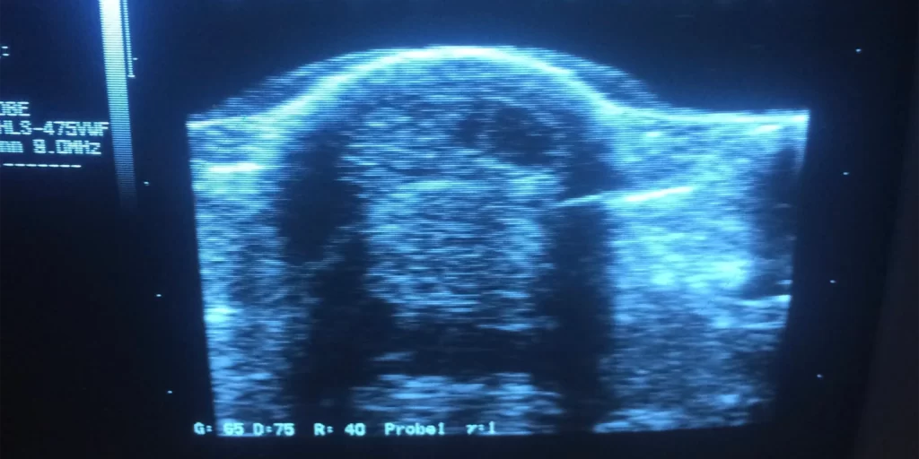 An image of an ultrasound